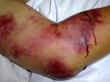 سازمان دامپزشکی: بیماری "تب‌ کریمه‌کنگو" تاکنون جان چهار نفر را گرفته است